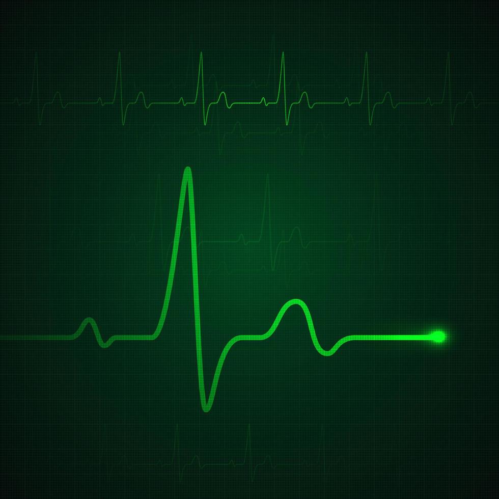 Heart pulse on green display. Heartbeat graphic or cardiogram. Medicine monitoring stress rate. Vector illustration