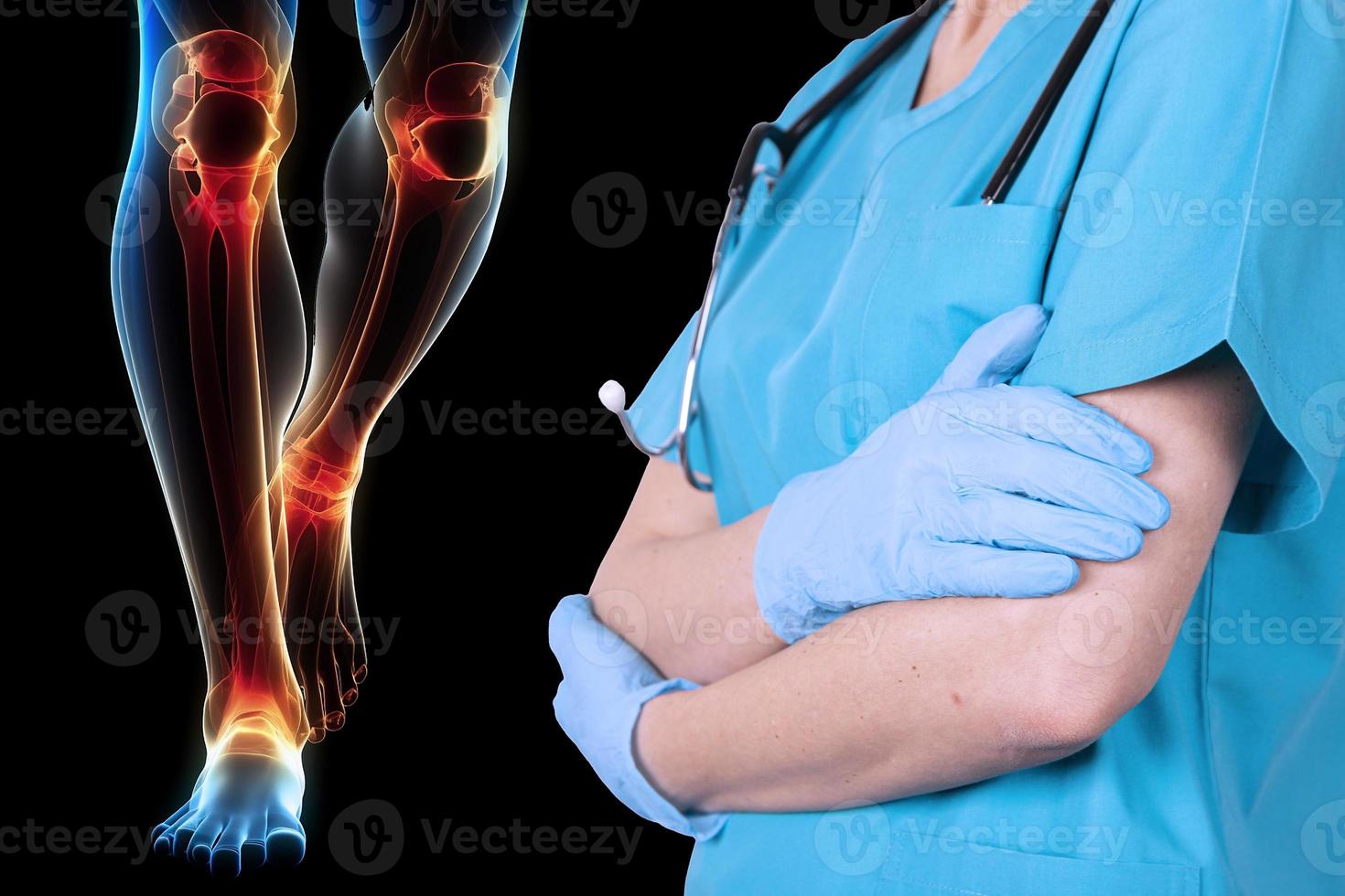 Knee injury. X-ray of a person's leg with illuminated area of the meniscus of the knee against the background of the doctor. Recommendations of the doctor, poster. photo