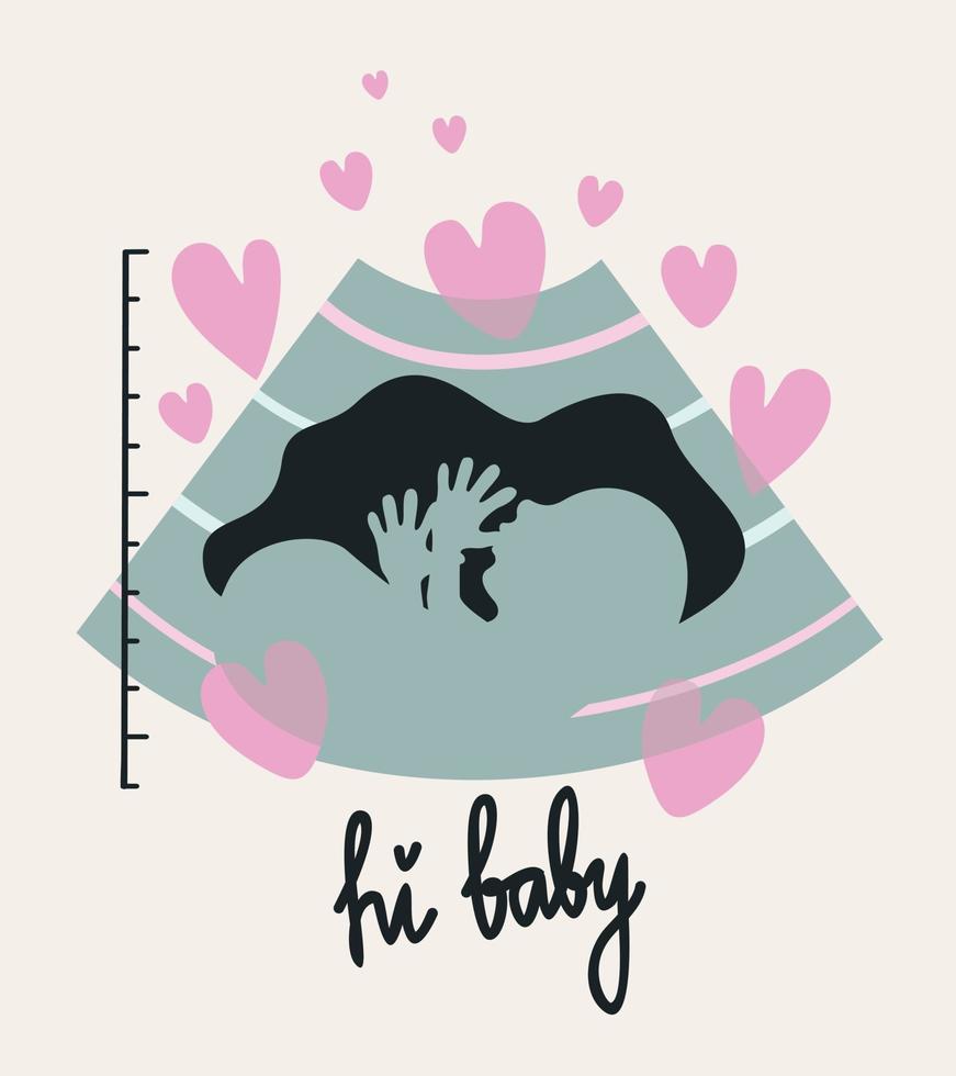 Prenatal ultrasound. Vector isolated illustration with hearts and lettering.