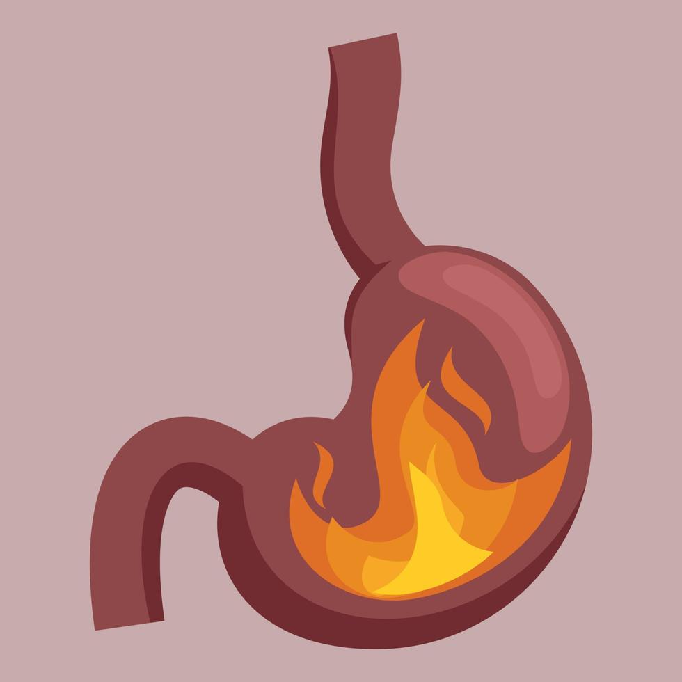 Vector Image Of A Fire Inside A Heart
