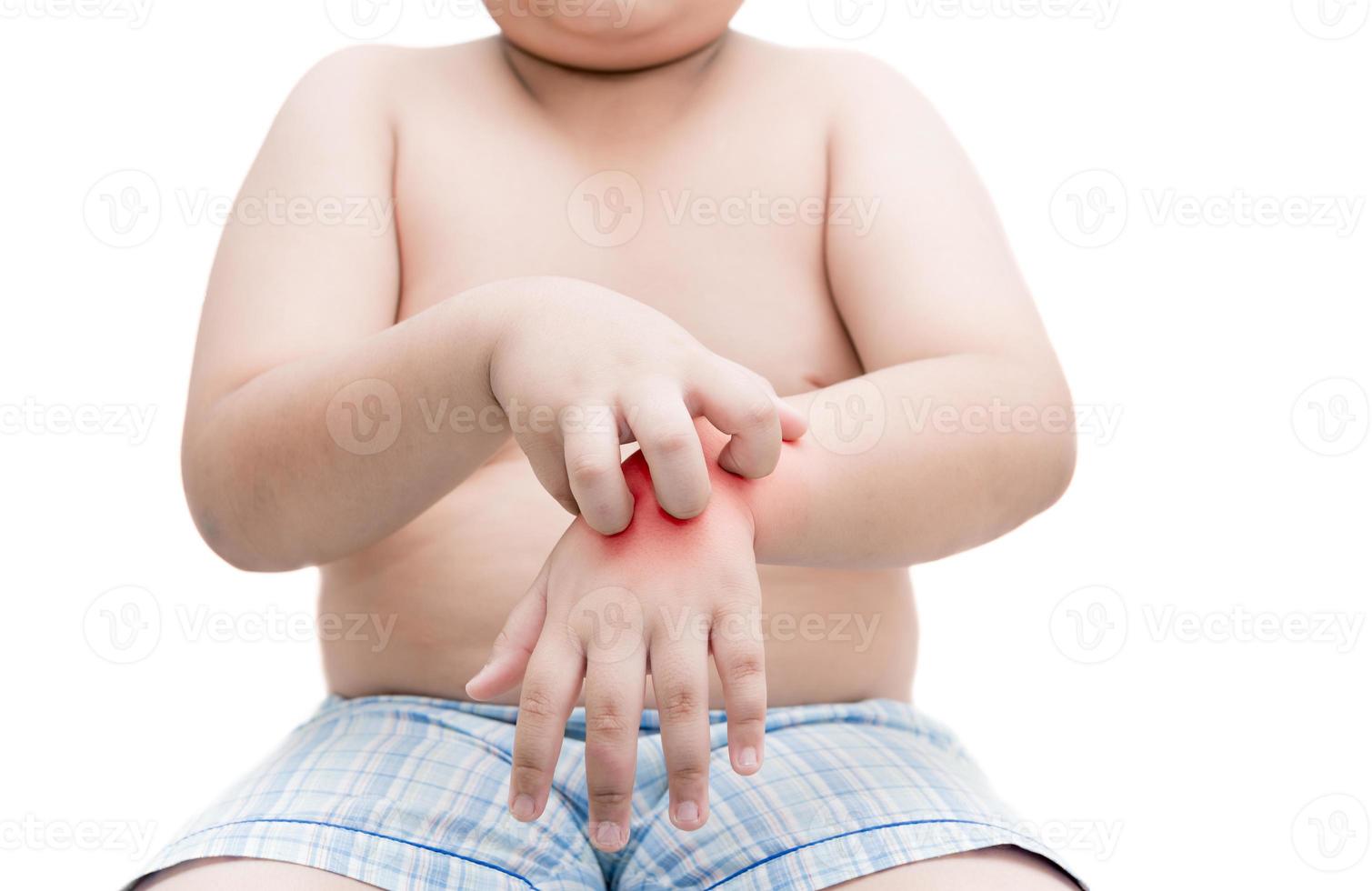 obeso grasa chico rasguño el picar con mano. Comezón aislado foto