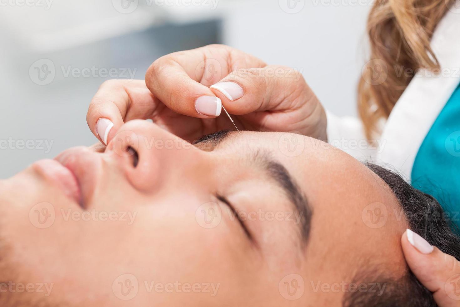 médico ejecutando facial acupuntura en un joven masculino paciente foto