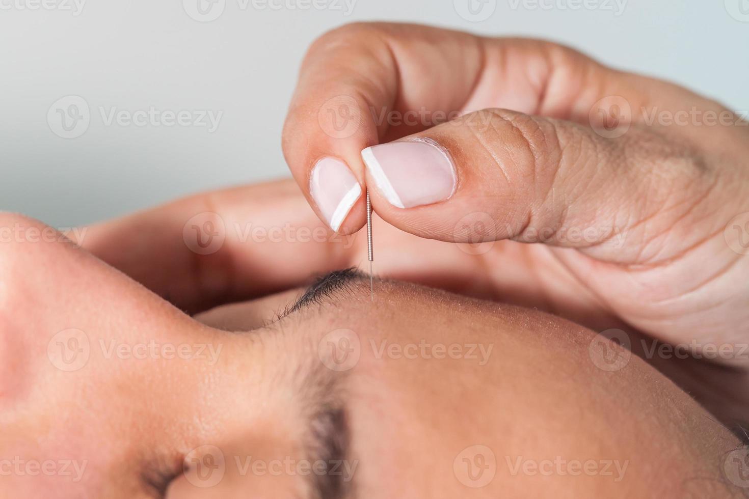 Doctor performing facial acupuncture on a young male patient photo