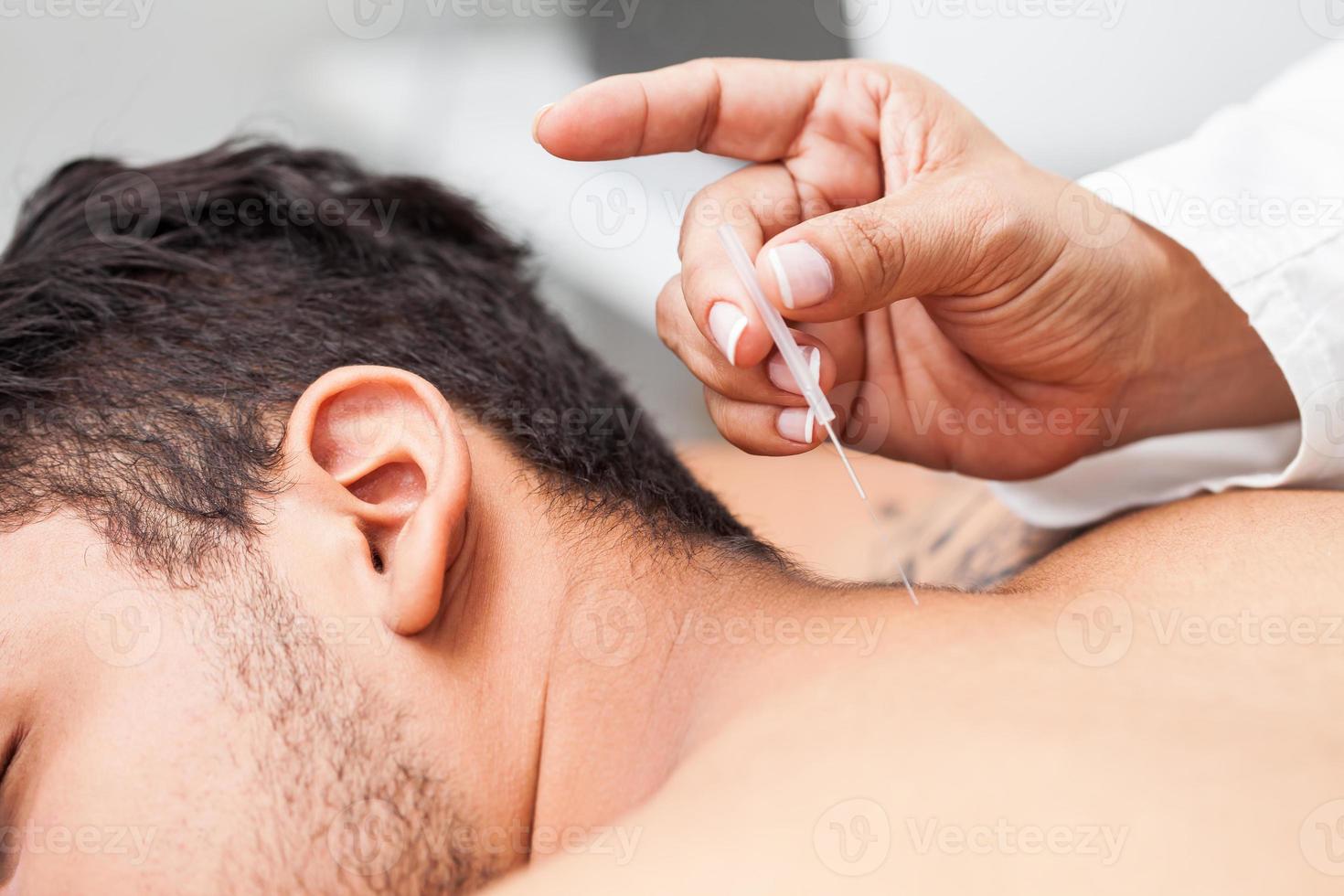 Doctor performing acupuncture on a young male patient photo