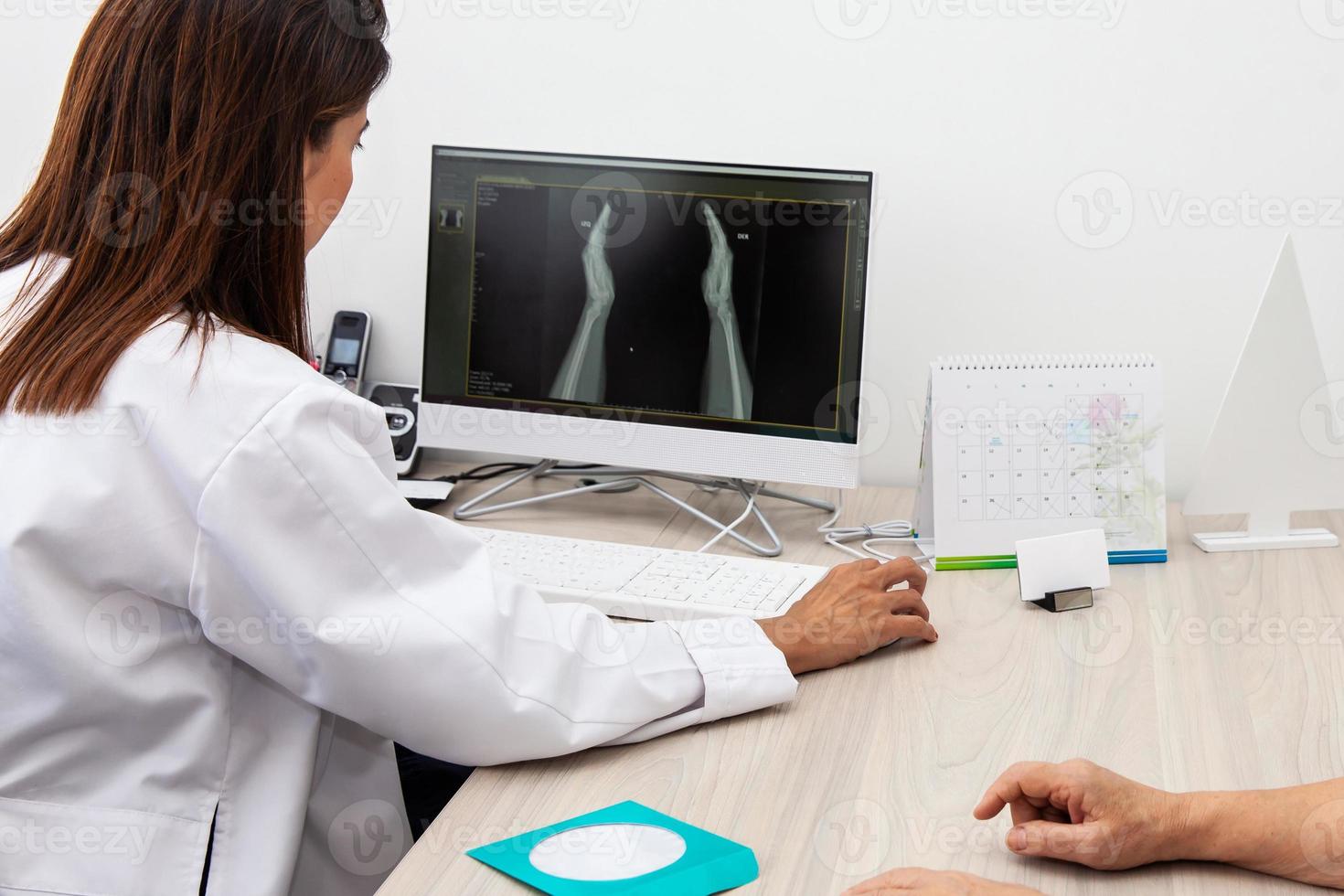 Traumatologist female doctor reviewing an x-ray of a patient's hands. Skeleton bone disease exam and medic aid. Career concept. photo