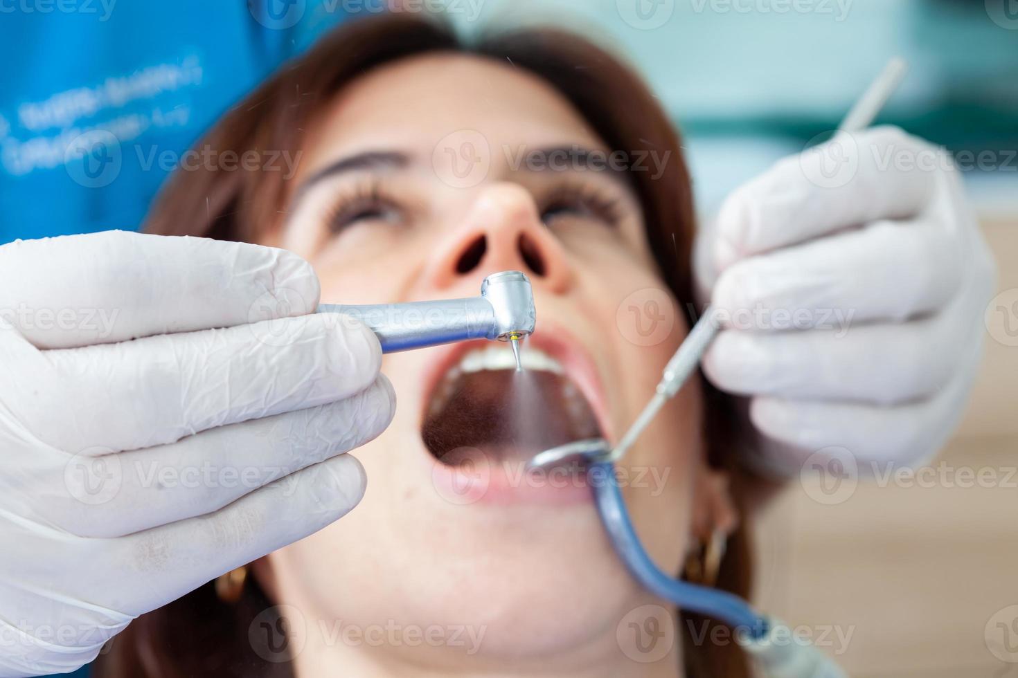 de cerca de un dental instrumentos siendo usado por el dentista durante un dental tratamiento para un hermosa mujer. foto