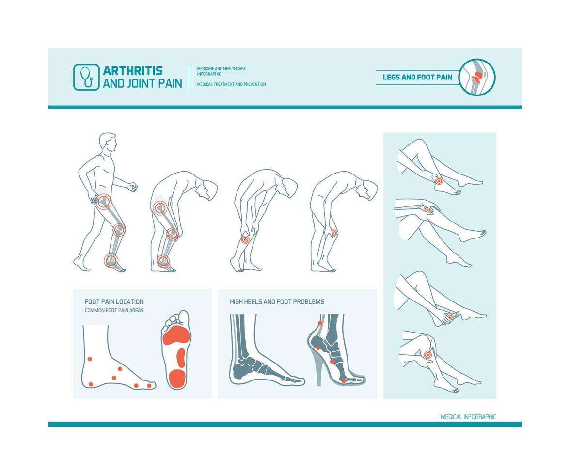 pie dolor y artritis infografía vector