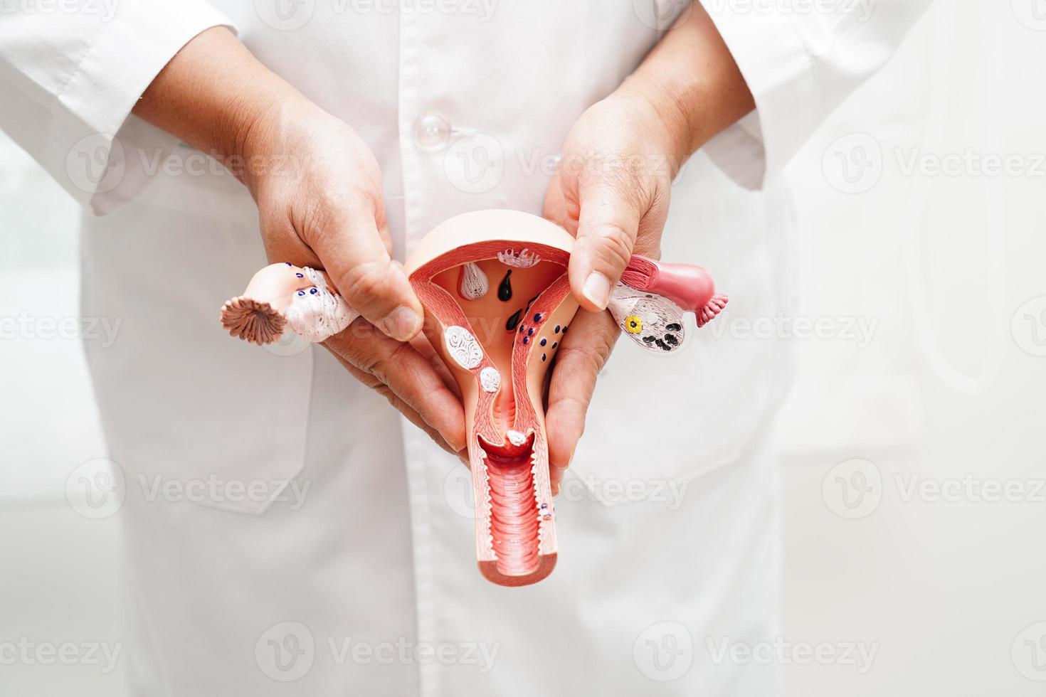 Uterus, doctor holding anatomy model for study diagnosis and treatment in hospital. photo