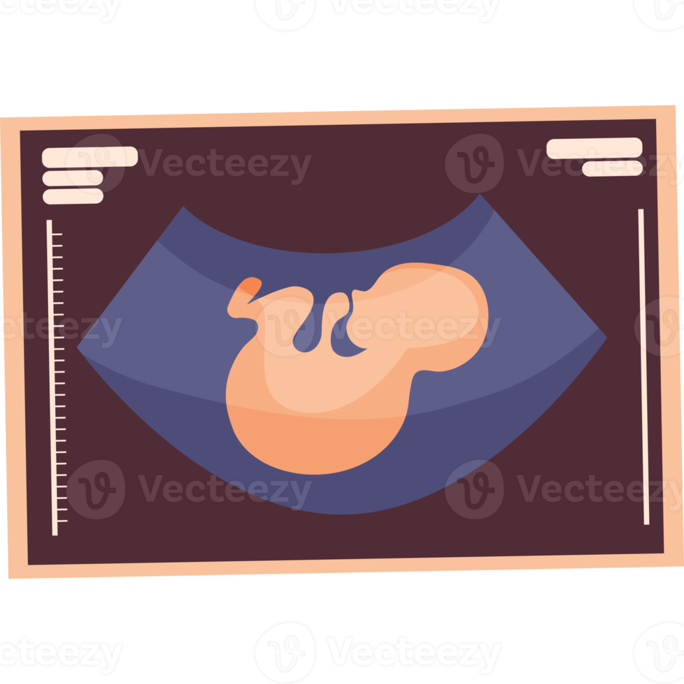 echografie afbeelding van kind png