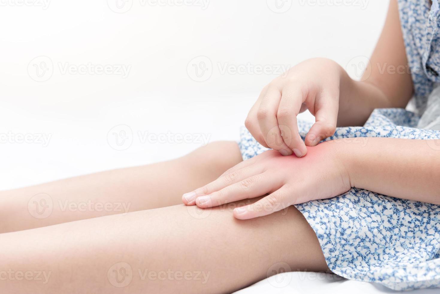 asian girl scratch the itch with hand because of mosquito bites photo