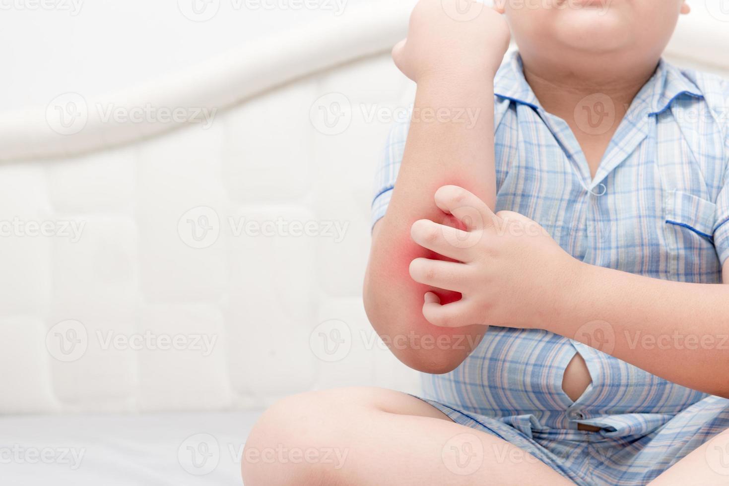 Obese fat boy scratch the itch with hand his arm photo