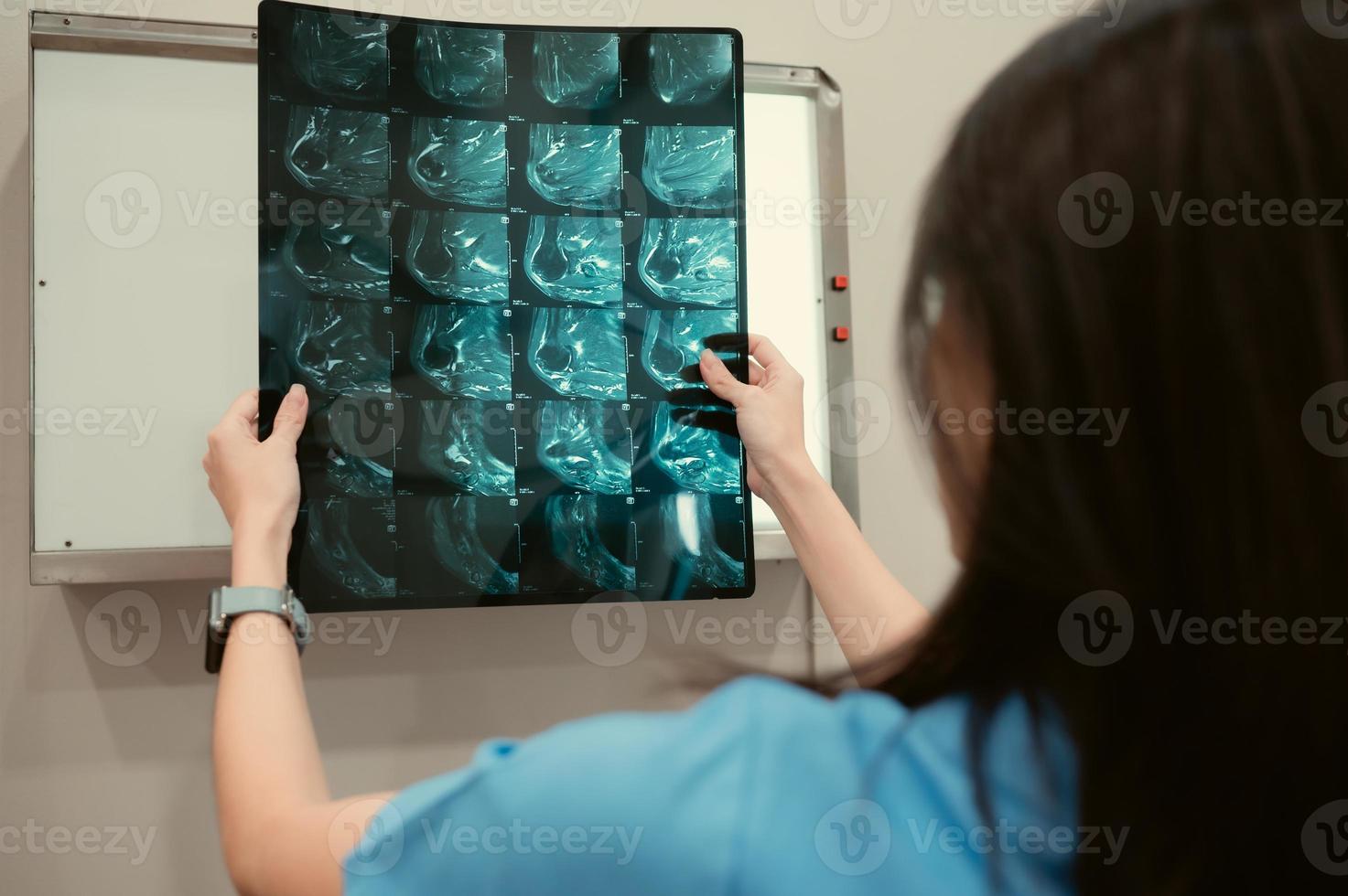 médico y del paciente radiografía película en hospital examen habitación foto