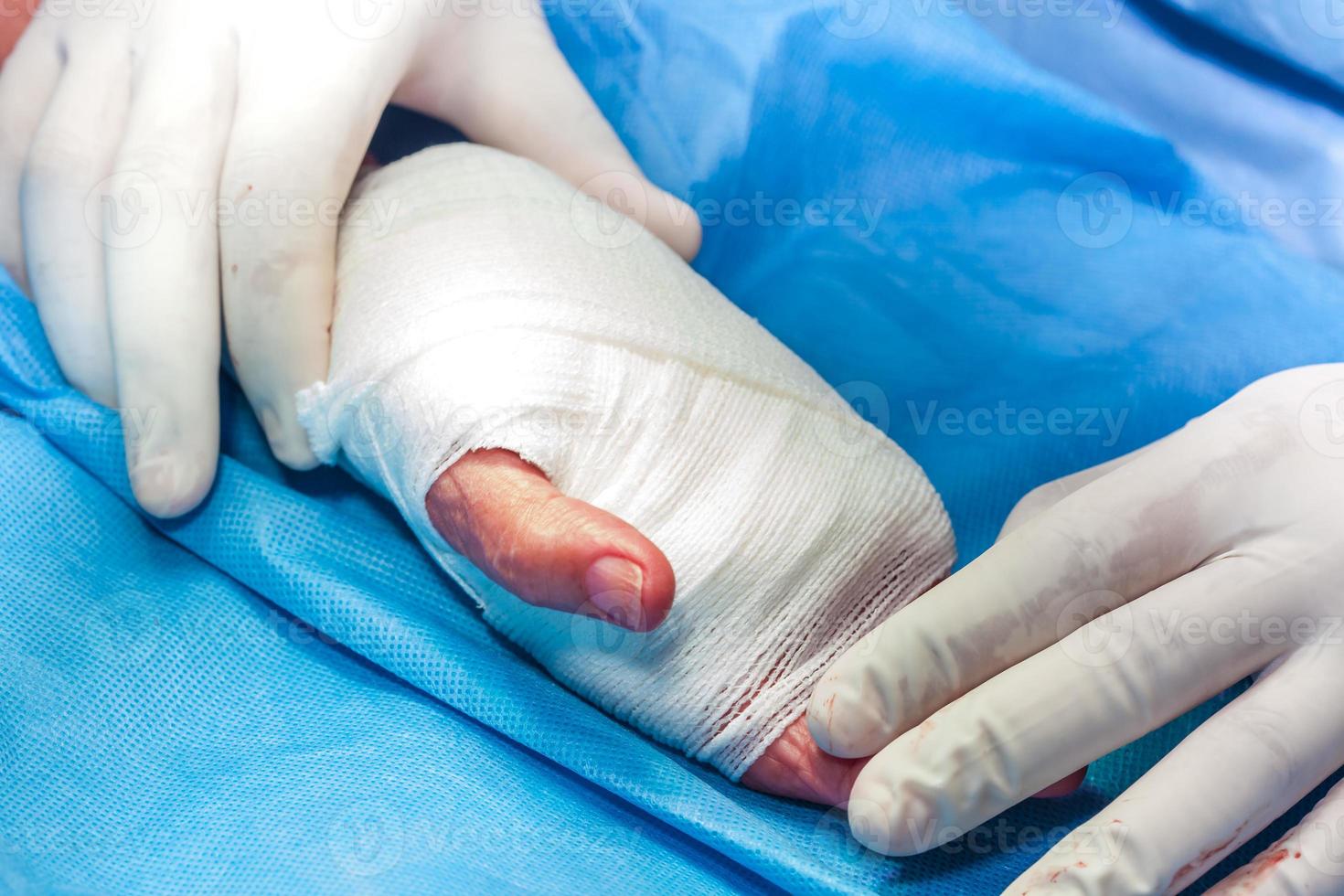 Surgeon bandaging the hand of a patient at the end of surgery photo