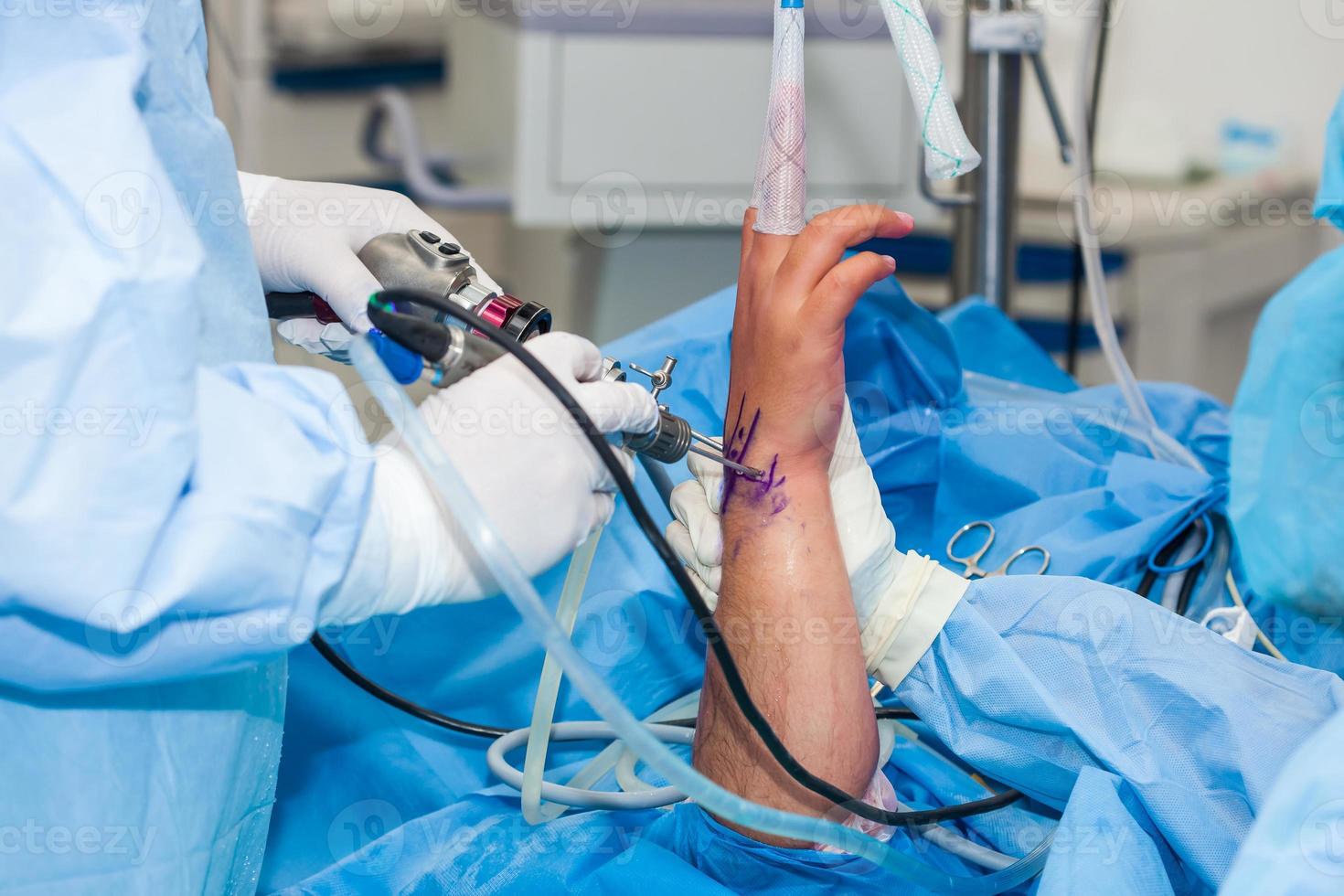 Group of orthopedic surgeons performing a wrist arthroscopy on a male patient photo