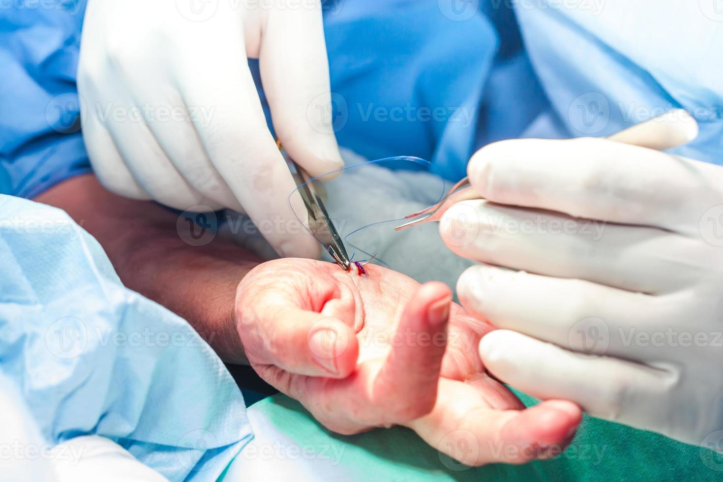 Surgeon suturing the hand of a patient at the end of surgery photo