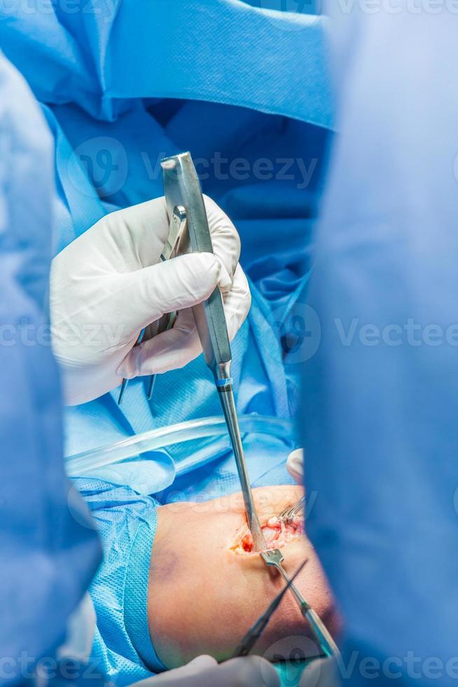 Group of orthopedic surgeons performing surgery on a patient arm photo