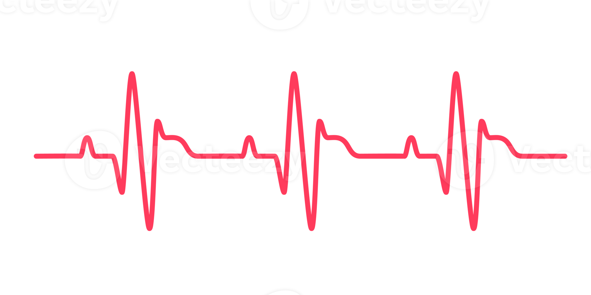 Herz Rhythmus Graph Überprüfung Ihre Herzschlag zum Diagnose png