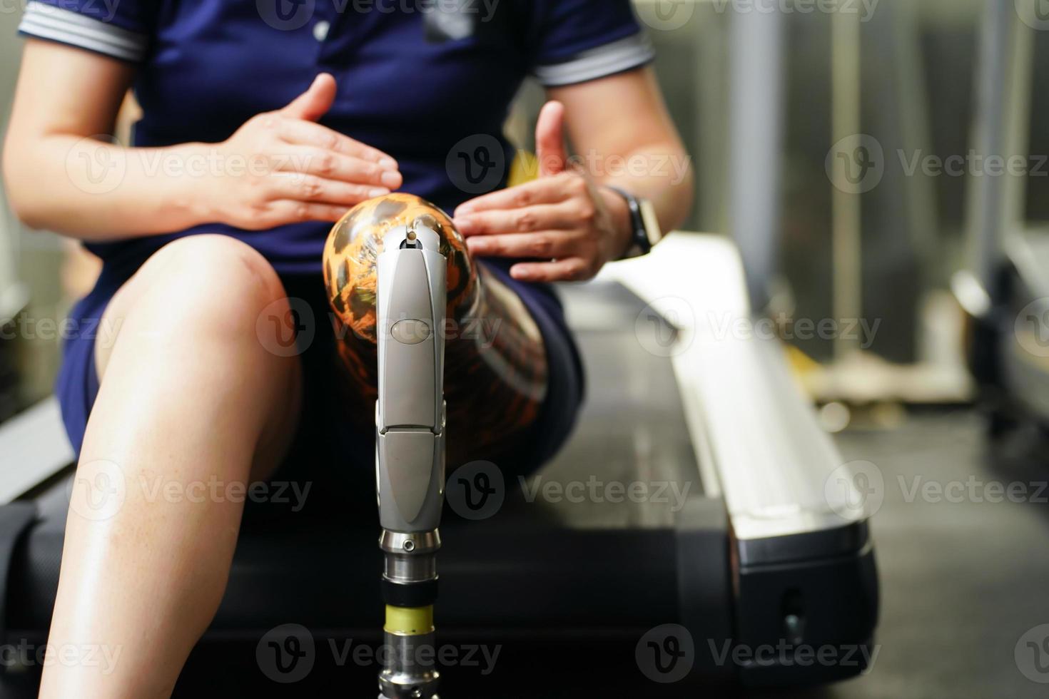 Young female with one prosthetic leg with the practice of using prosthetic legs to walk, exercise and and daily activities photo