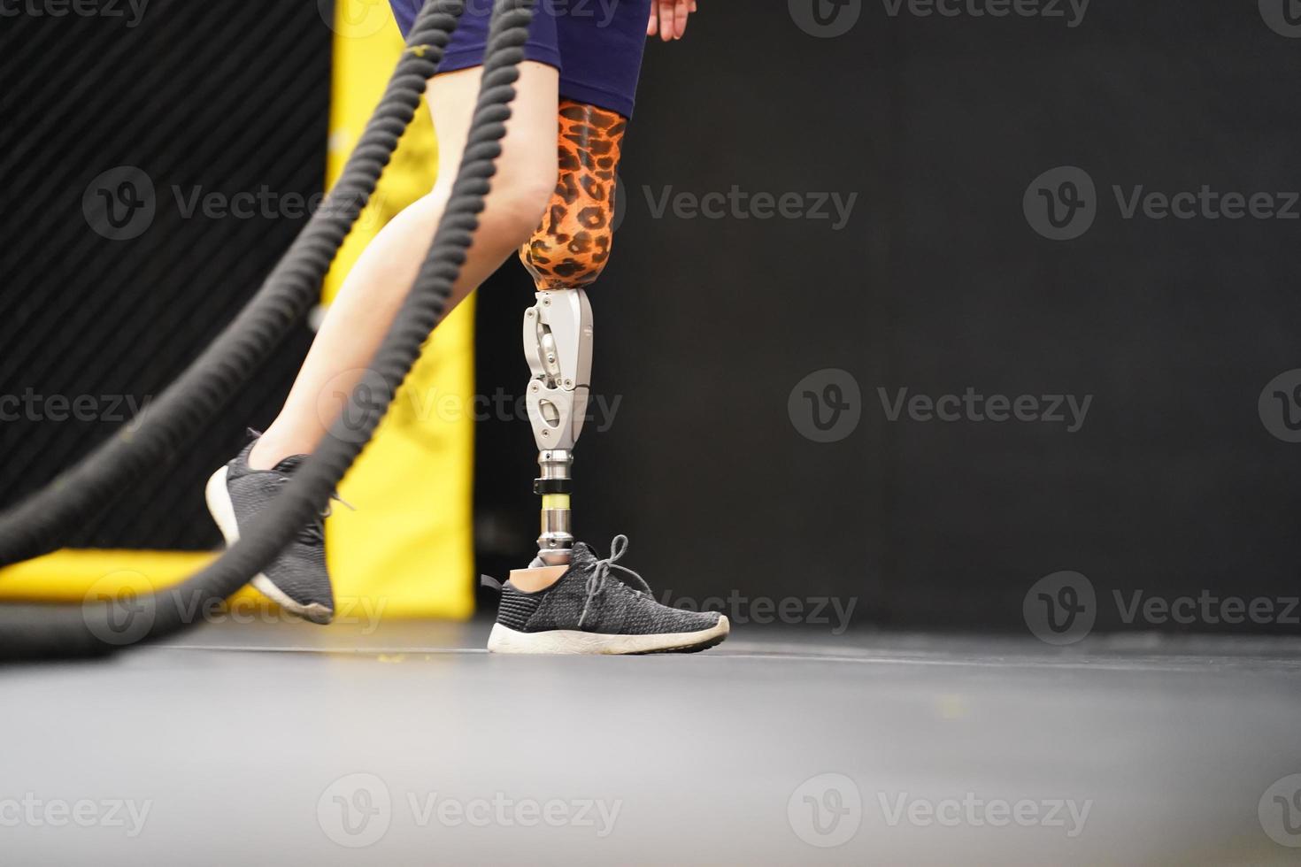 Young female with one prosthetic leg with doing arm and shoulder exercises with a rope to practice balancing with prosthetic leg, Concept of life of women with prosthetic legs. photo