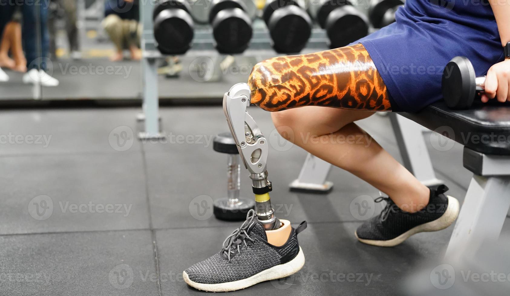 Young female with one prosthetic leg warms up by lifting light weights. Concept of living a woman's life with a prosthetic limb. photo