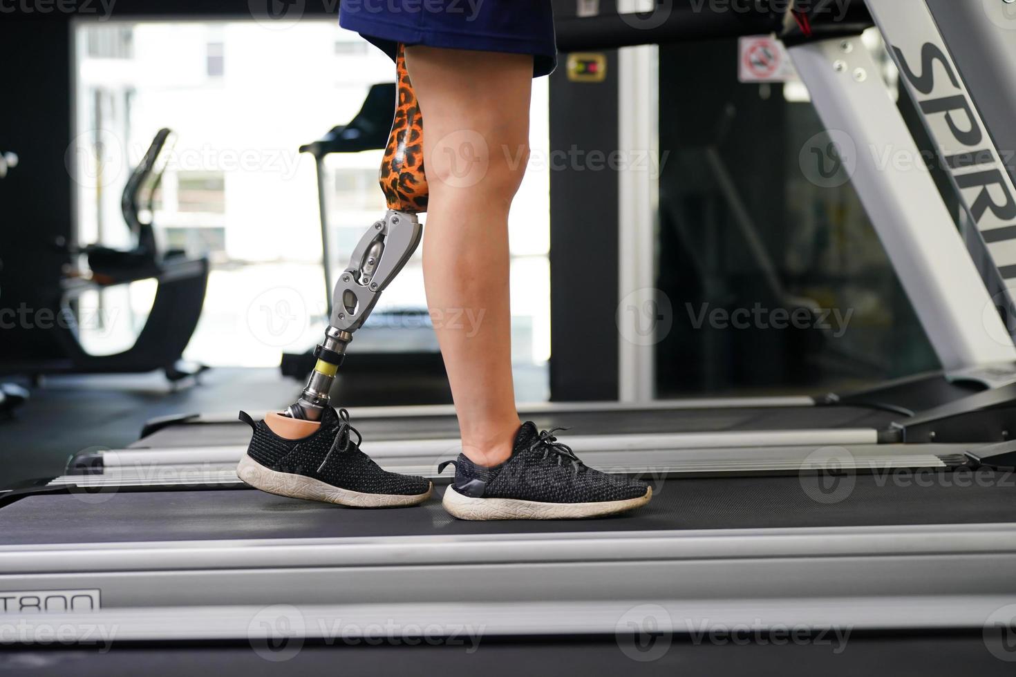 Young female with one prosthetic leg with exercise by walking on a treadmill to practice walking with the other prosthetic leg to be more flexible. photo