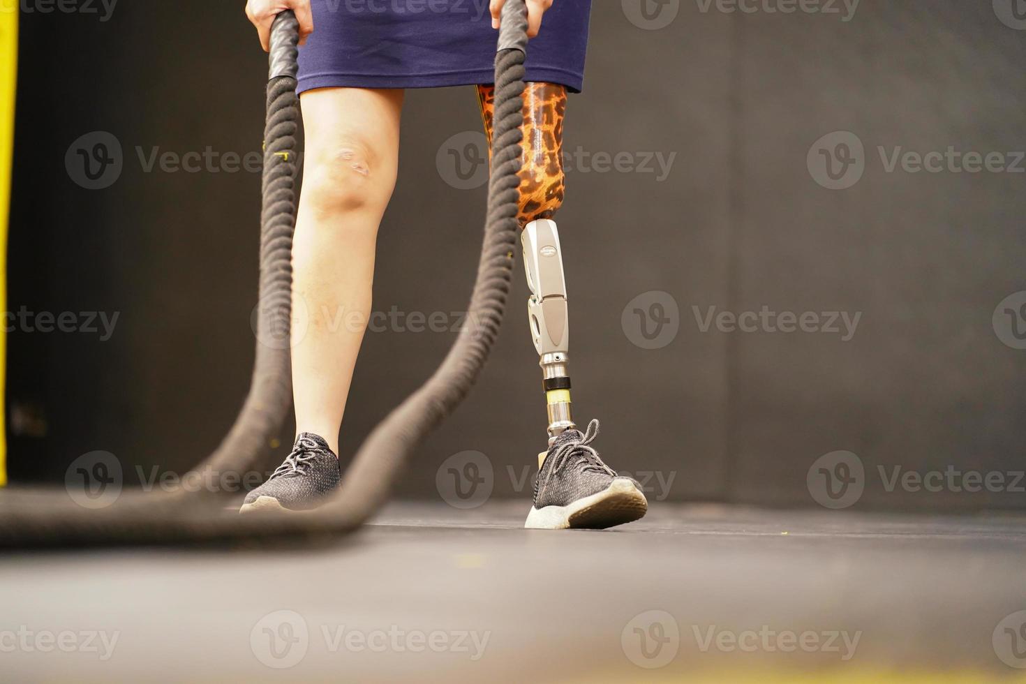 Young female with one prosthetic leg with doing arm and shoulder exercises with a rope to practice balancing with prosthetic leg, Concept of life of women with prosthetic legs. photo