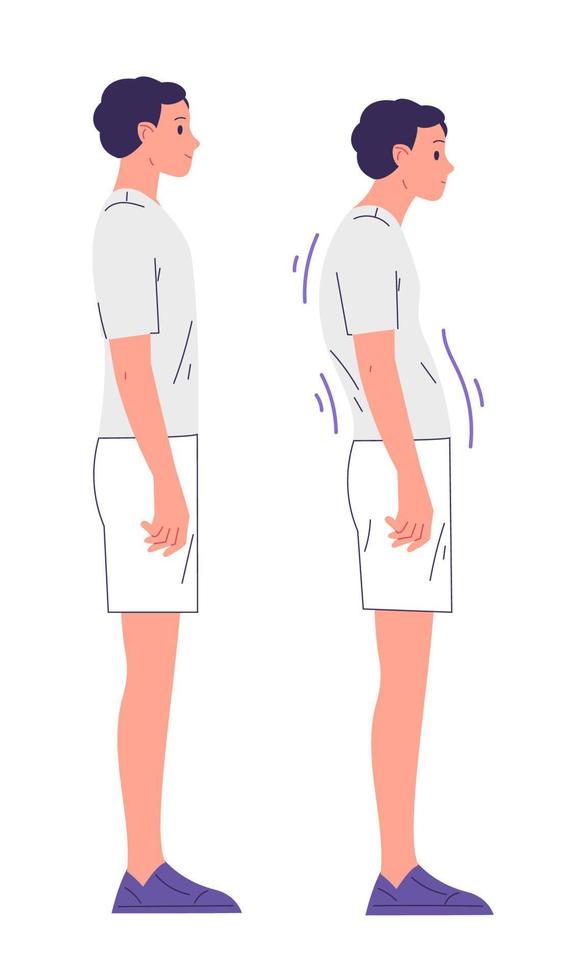 Boy with proper posture and with a posture problem vector