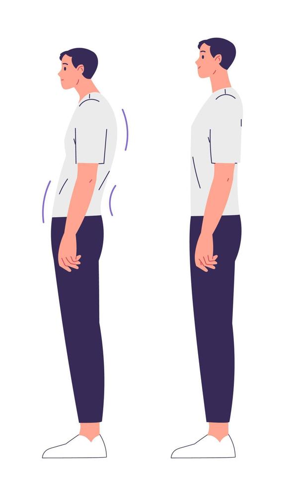 Man with impaired posture and correct posture. Spinal curvature, scoliosis vector