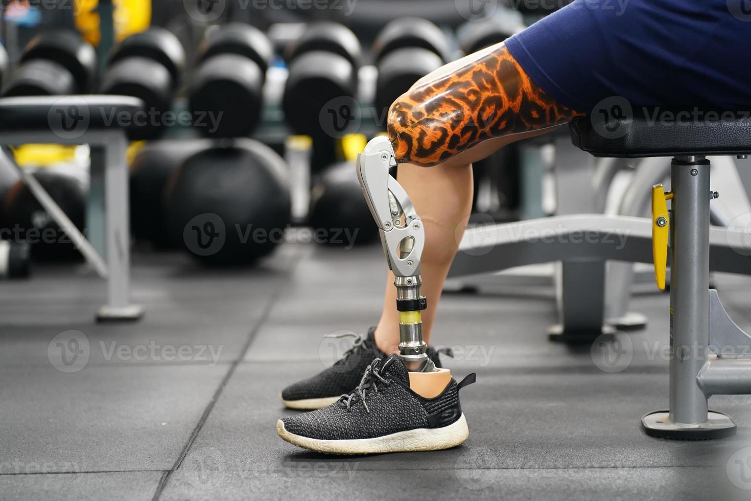 Leg amputee woman lifestyle hi-res stock photography and images