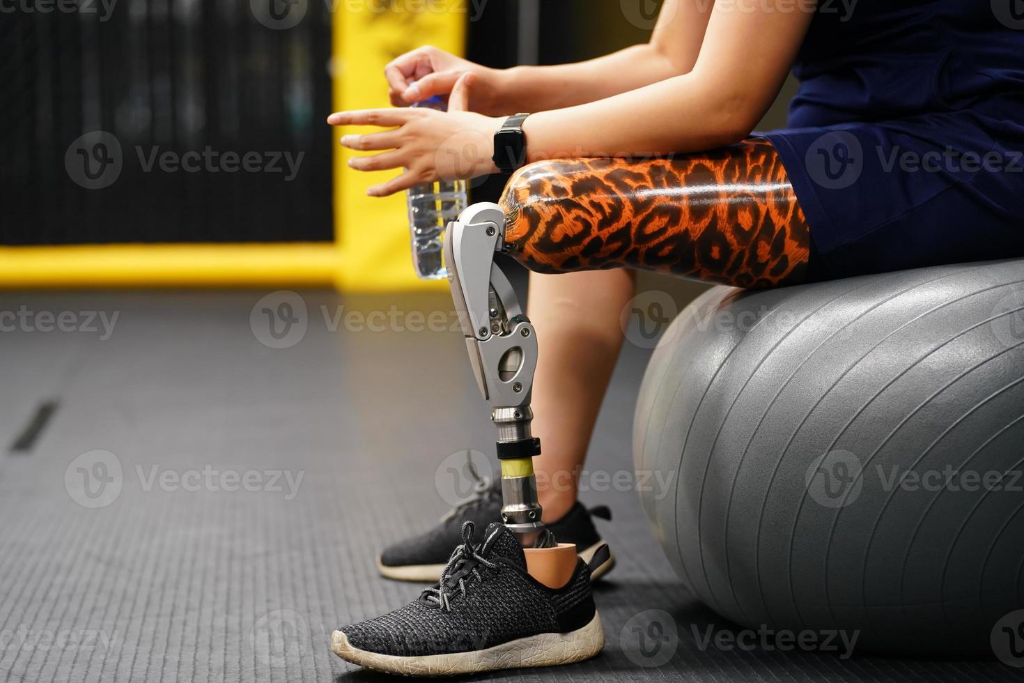 Young female with one prosthetic leg with the practice of using prosthetic legs to walk, exercise and and daily activities photo