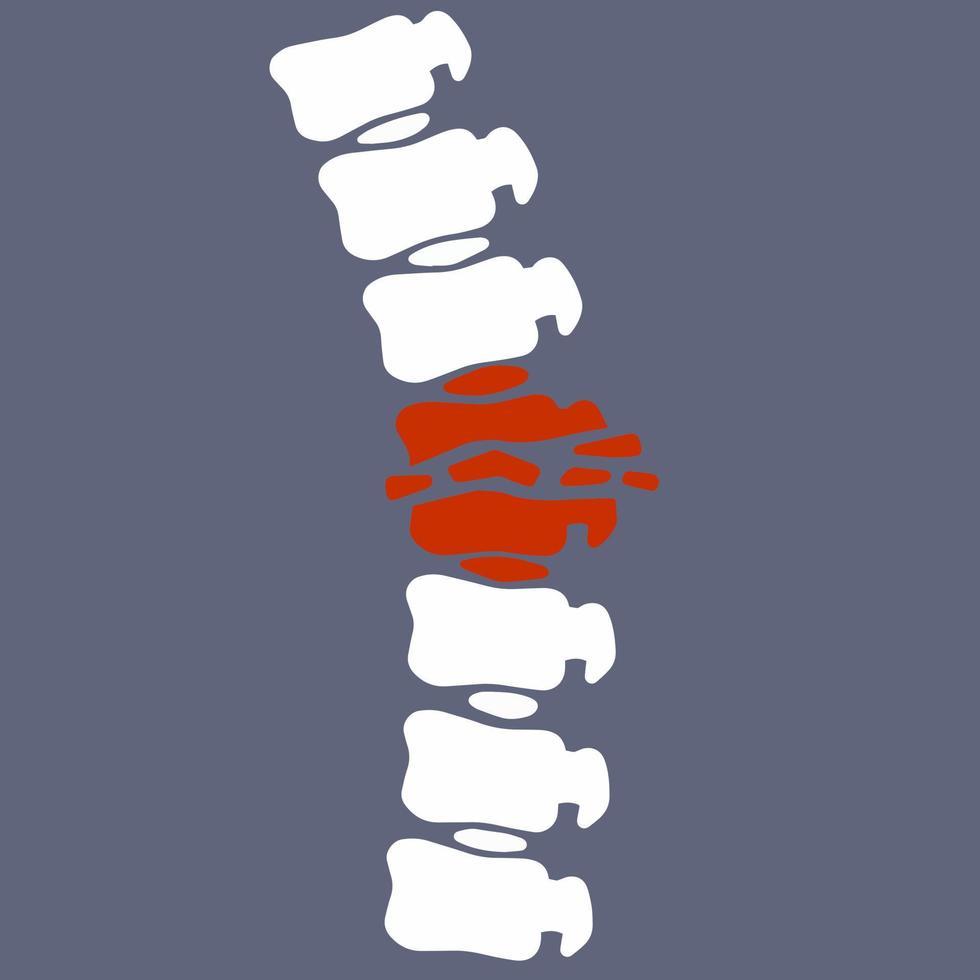 problemas con columna vertebral. postura asuntos. enfermo rojo lugar. grieta en blanco hueso. aumentador vaso. logo en círculo. vertebral columna. radiografía de interno órganos médico cuidado. fractura de intervertebral discos vector