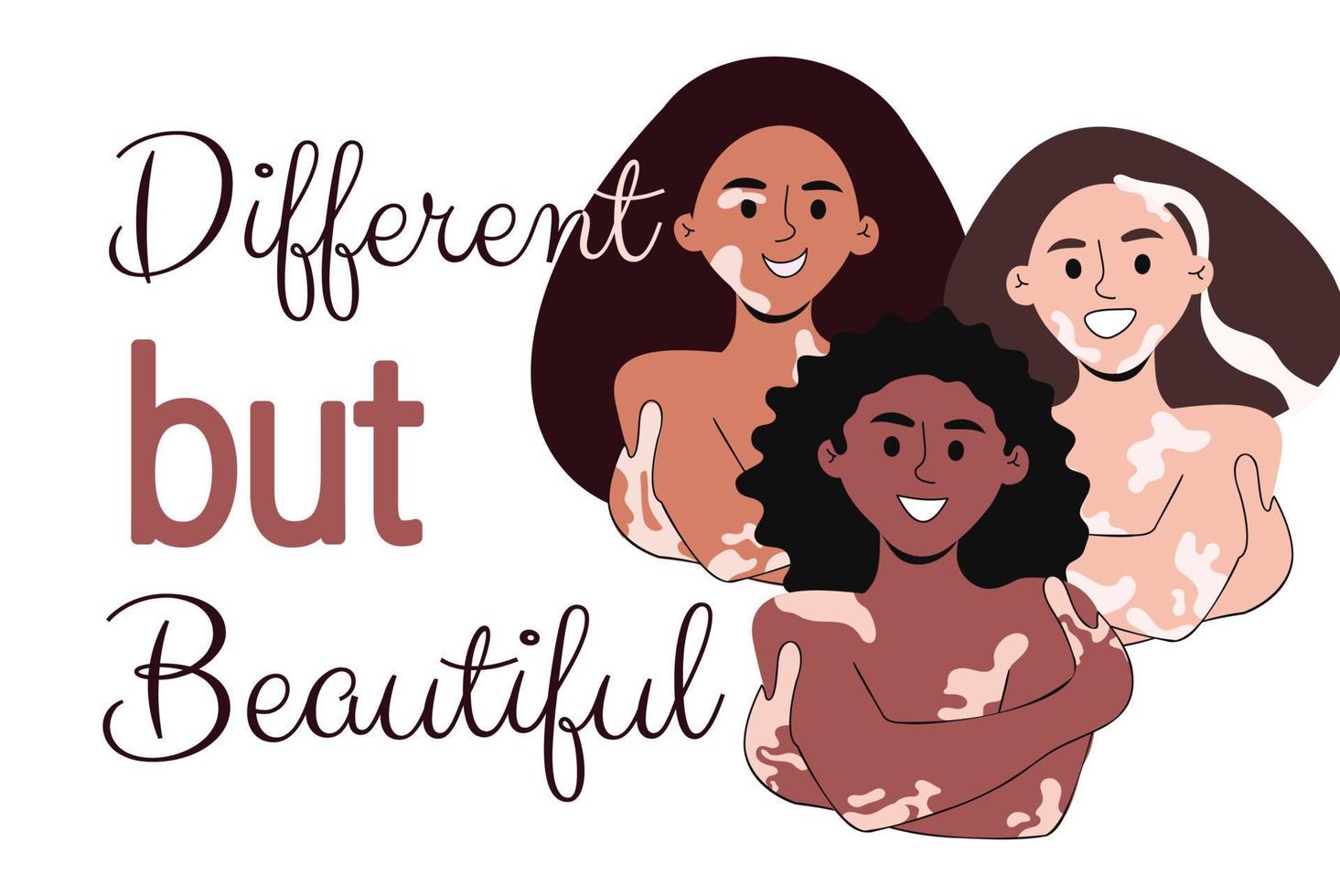 Women with vitiligo Different but beautiful vector illustration