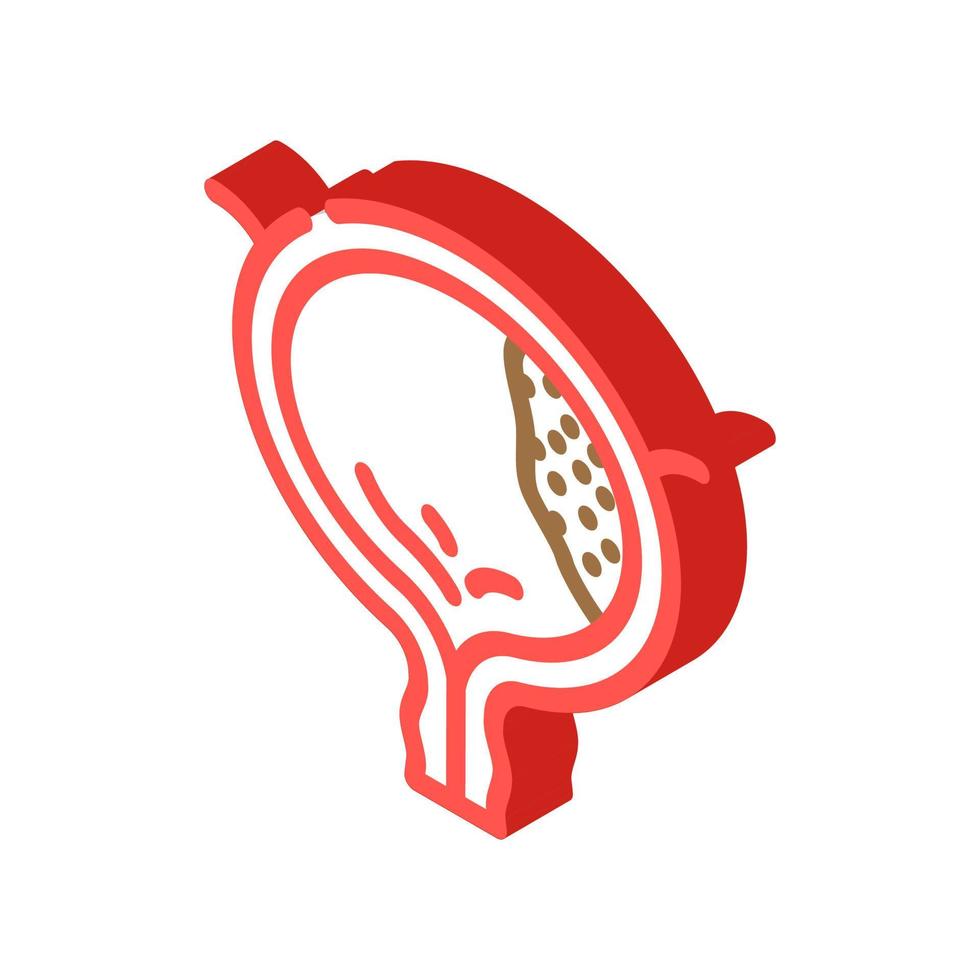 bladder cancer isometric icon vector illustration