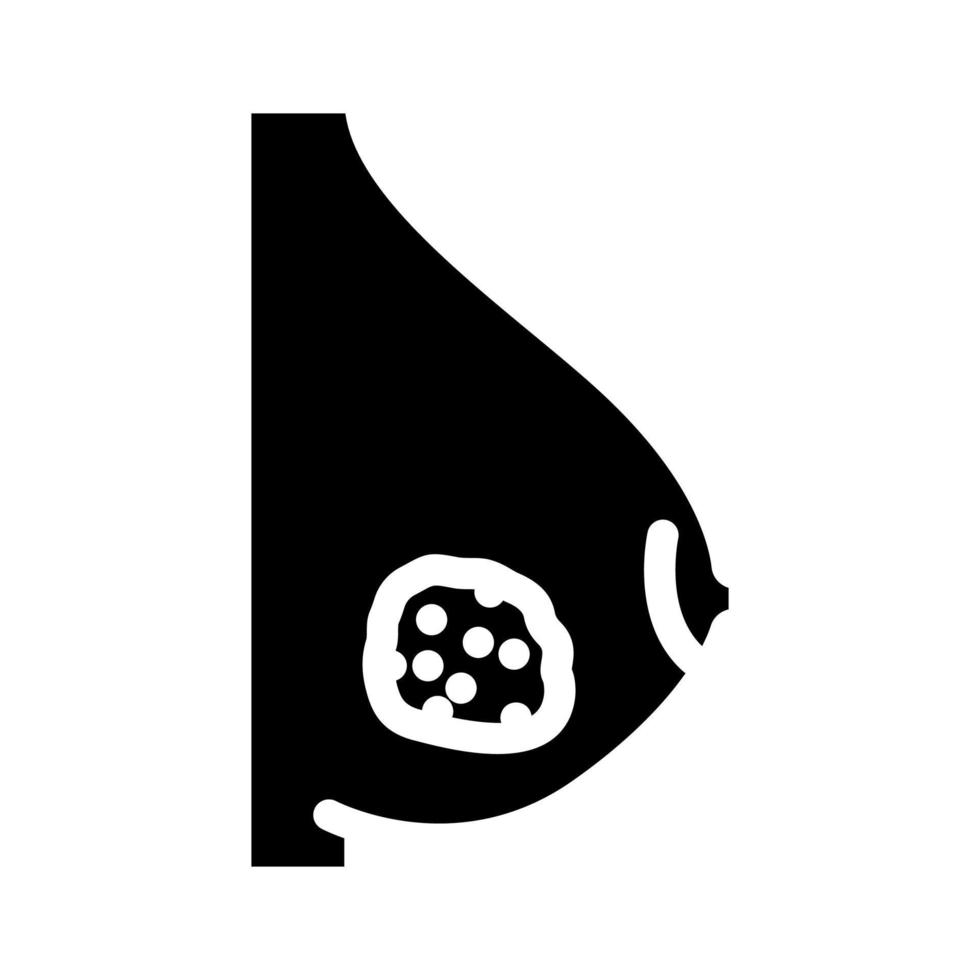 inflammatory breast cancer glyph icon vector illustration