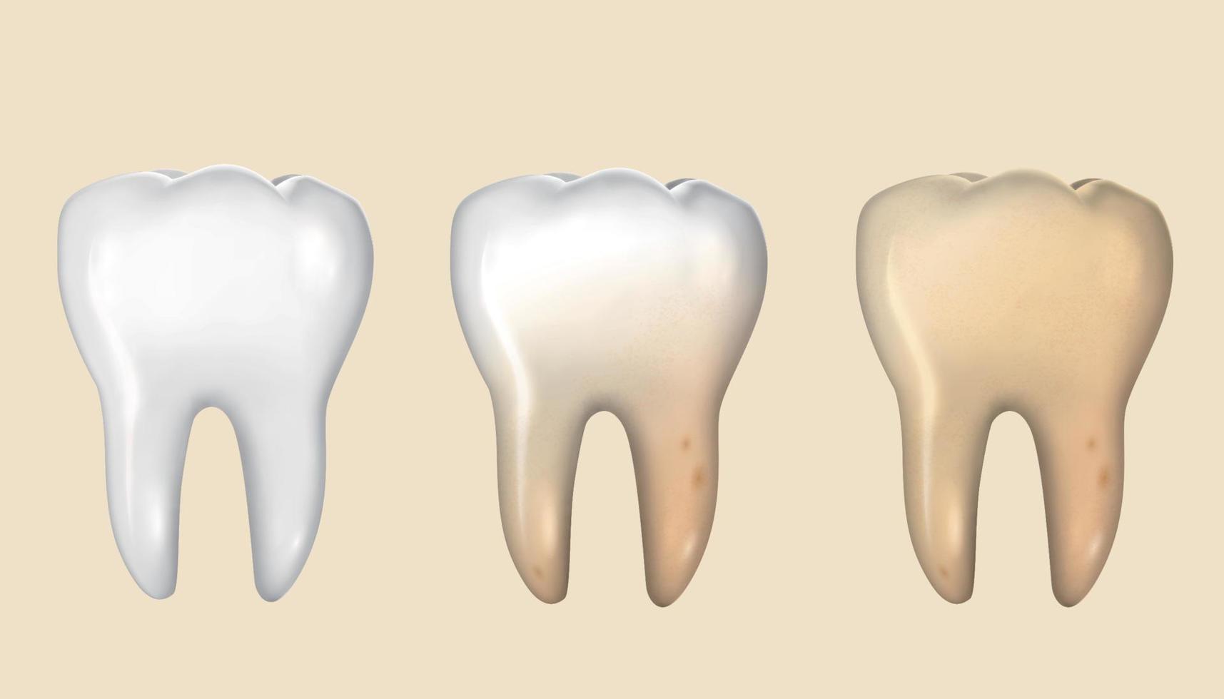 Teeth set from clean to dirty process, isolated on light yellow background, 3d illustration vector