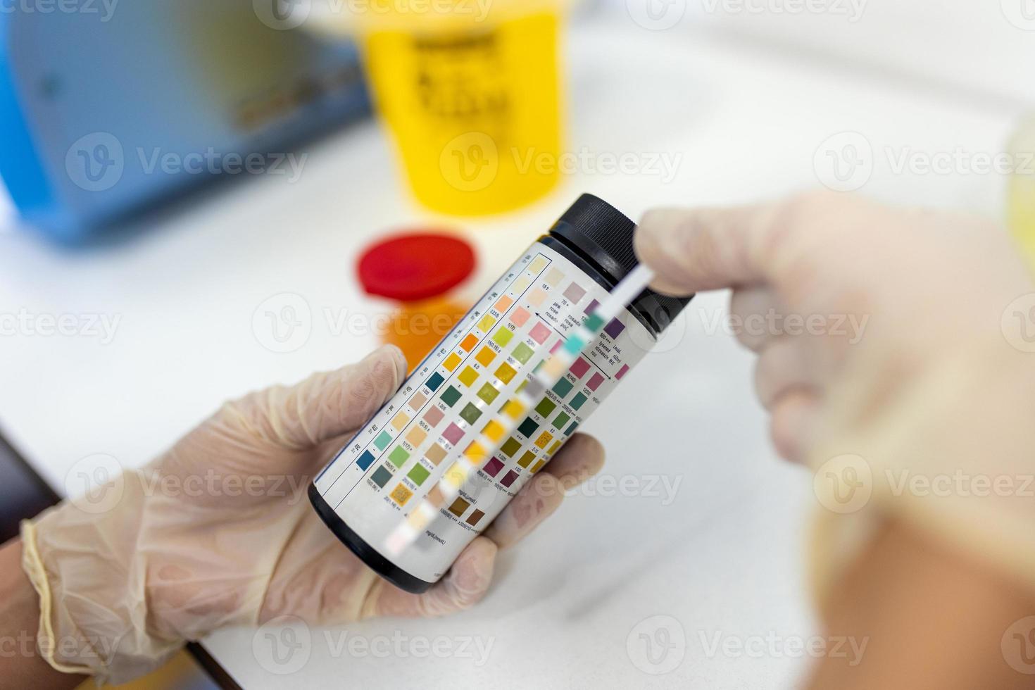 Reagent Strip for Urinalysis , Routine Urinalysis, check-up analysis in laboratory. Medical report and urine test strips photo
