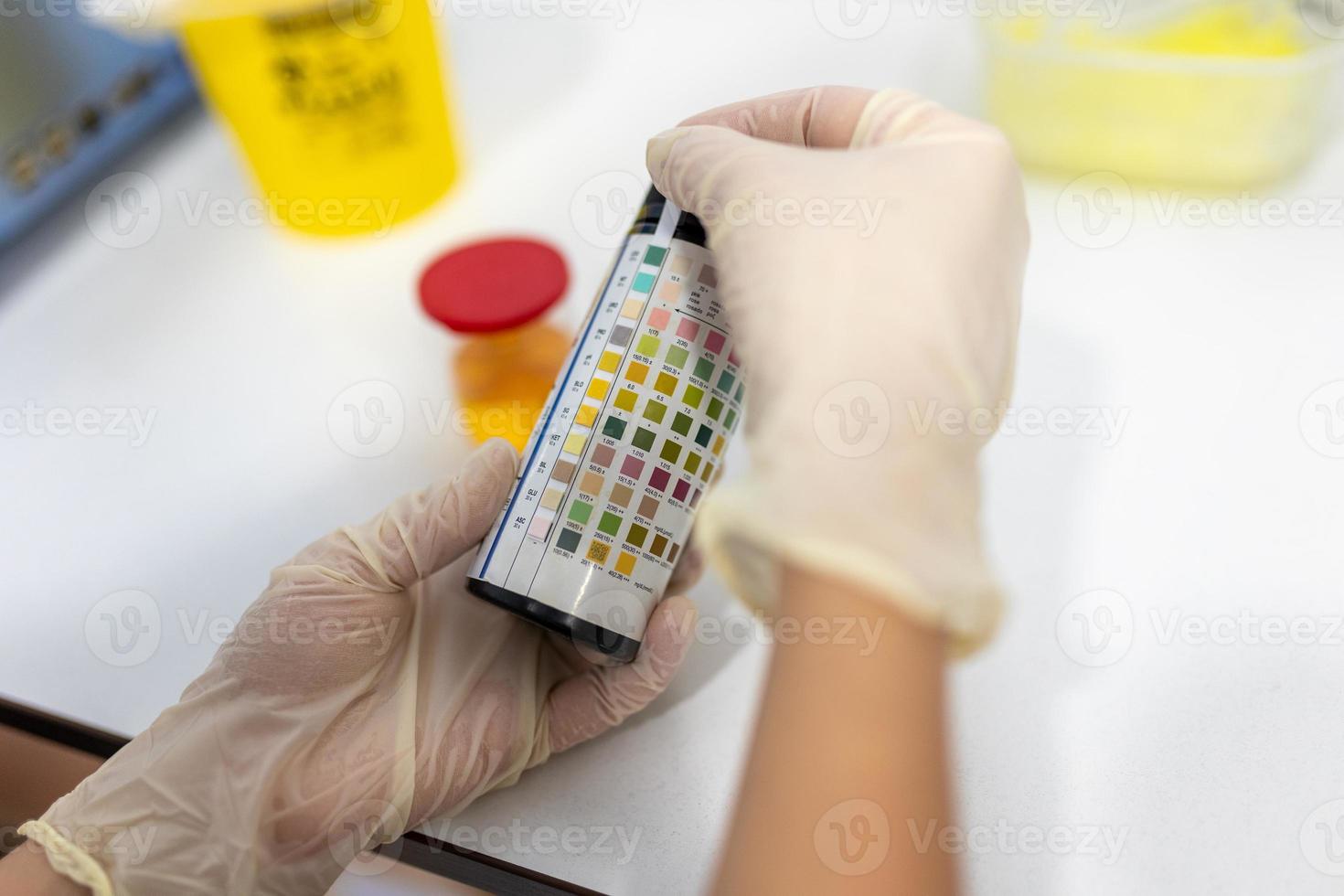 Reagent Strip for Urinalysis , Routine Urinalysis, check-up analysis in laboratory. Medical report and urine test strips photo
