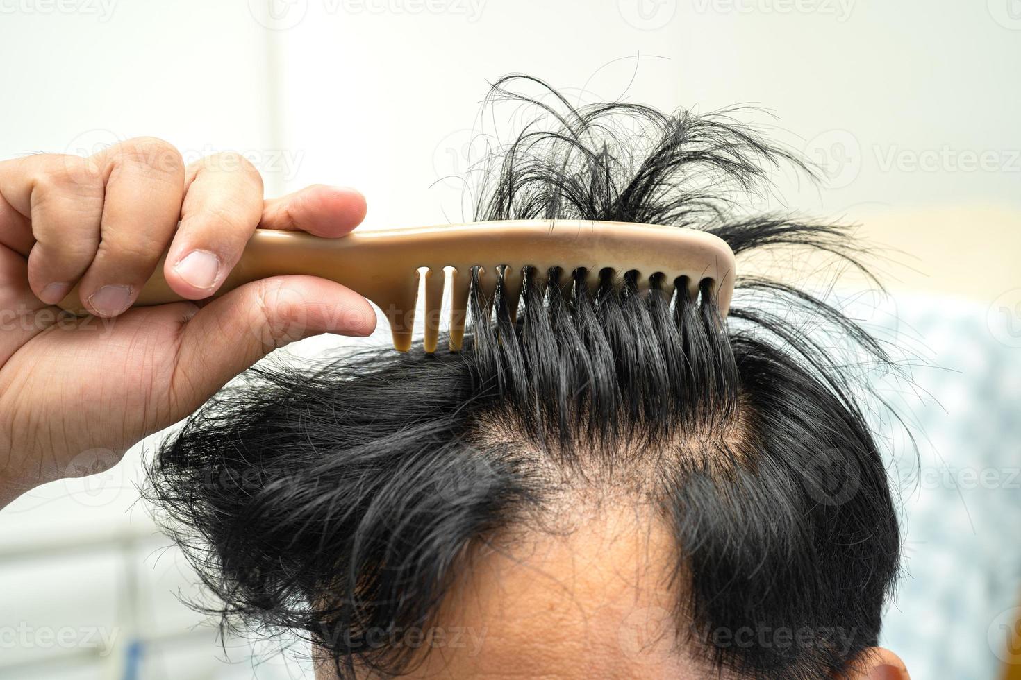 Bald at front of head and begin no loss hair glabrous of mature Asian business smart active office man. photo
