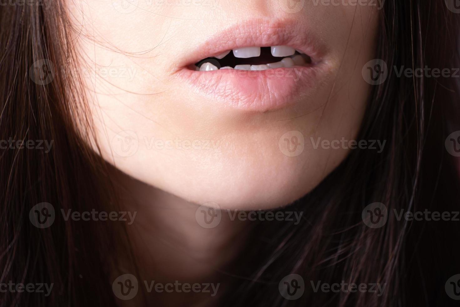 Close up of woman's open mouth with gap teeht. Lips and unusual teeth photo