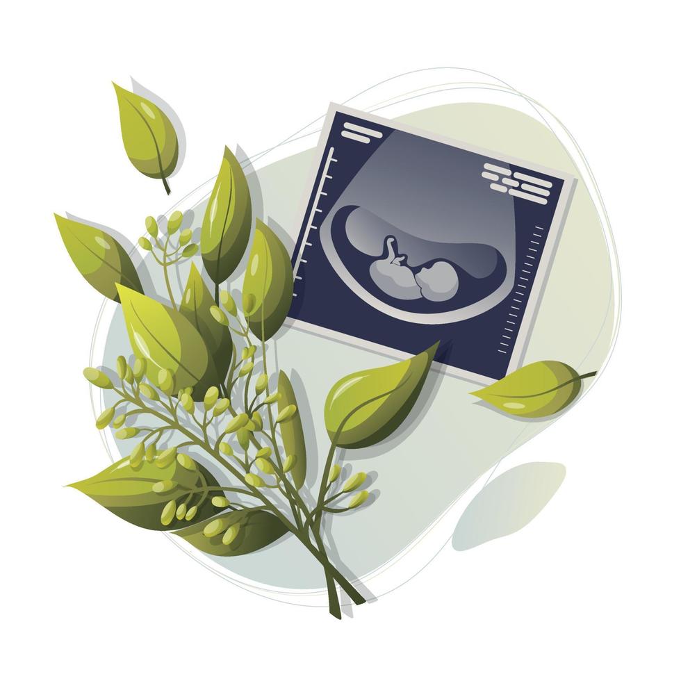 ultrasonido escanear de bebé con un Fresco árbol rama. Disparo de exploración embarazada mujer. feto silueta. médico diagnóstico y consulta. vector plano diseño . vector ilustración