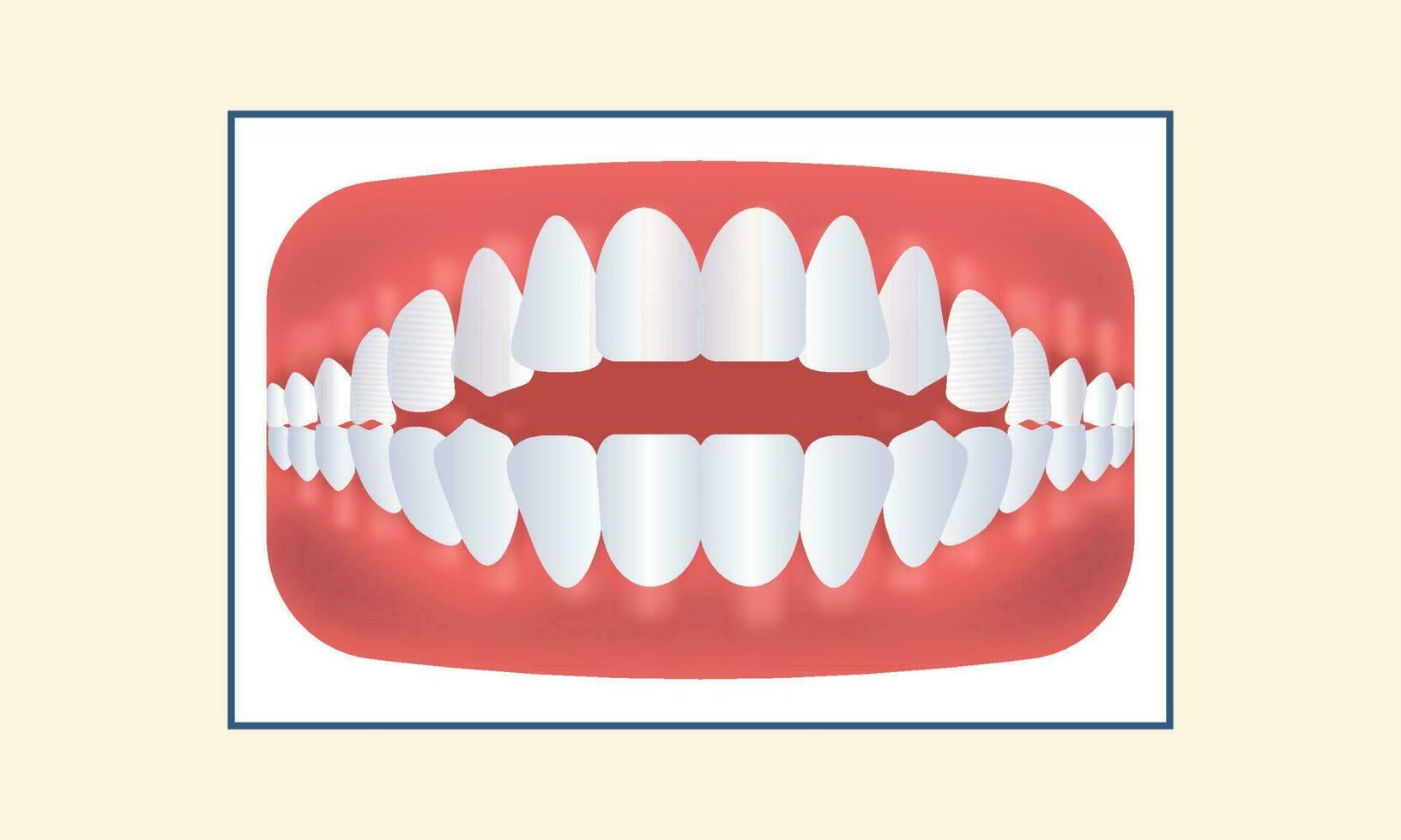 Open Bite Teeth Icon Against Yellow Background. vector