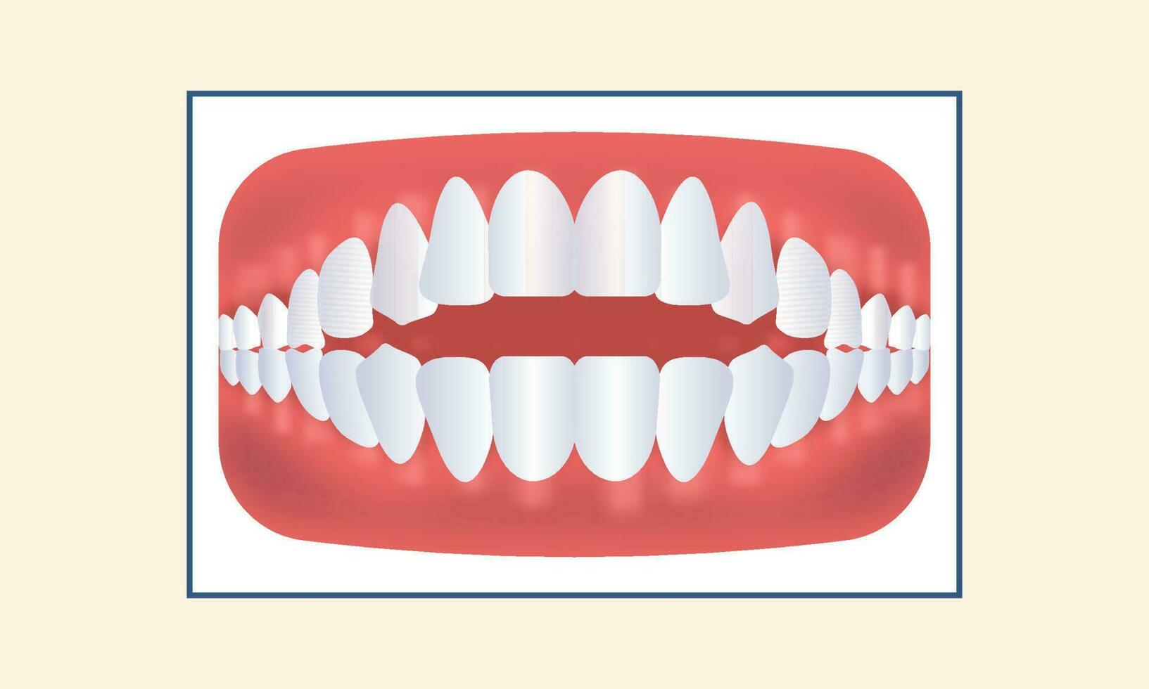 Open Bite Teeth Icon Against Yellow Background. vector