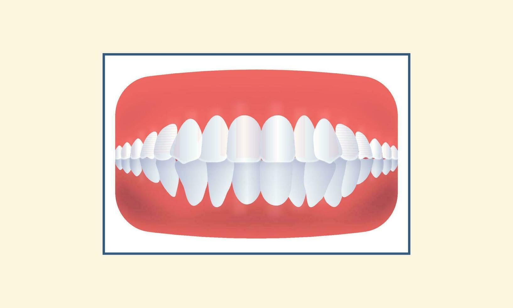 Crowding Human Teeth Icon Over Yellow Background. vector