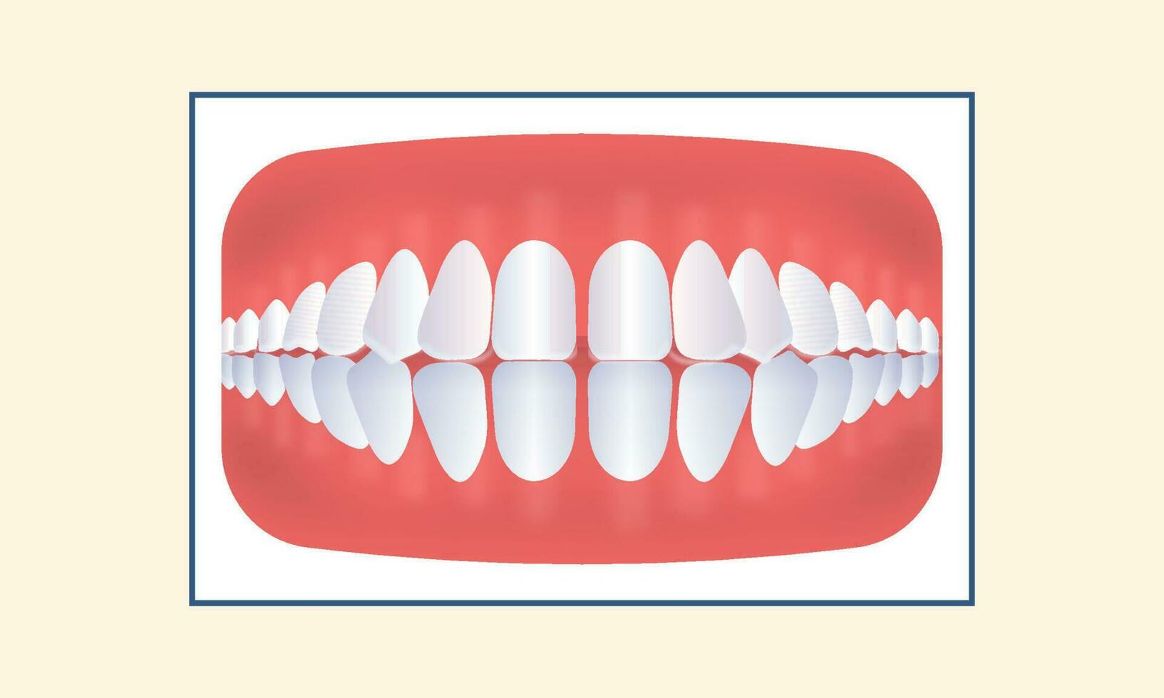 Excessive Spacing Teeth Icon On Yellow Background. vector