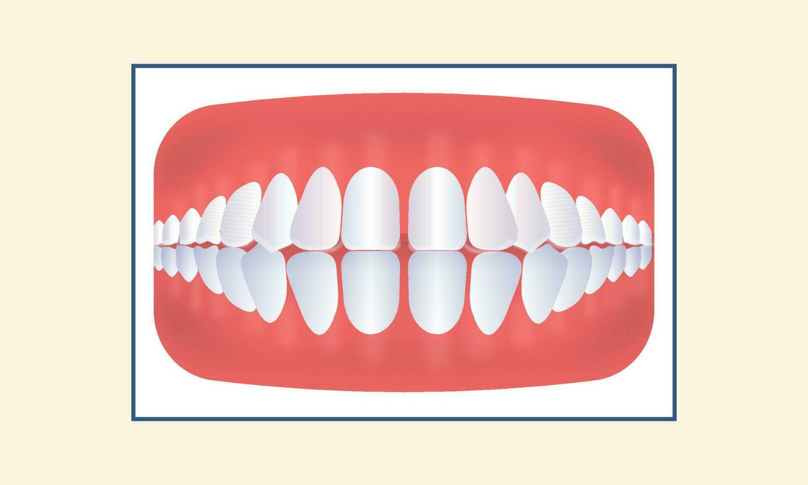 excesivo espaciado dientes icono en amarillo antecedentes. vector