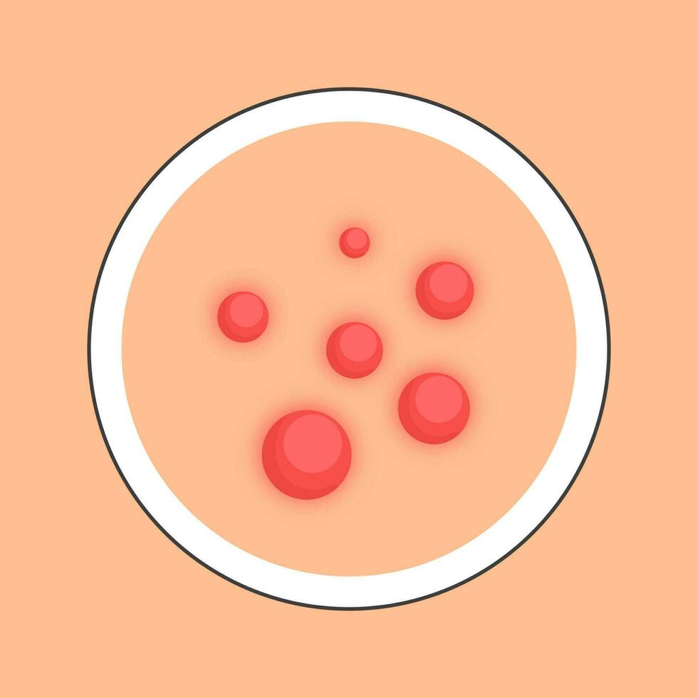 Flat Illustration Of Acne Skin Circle Icon. vector