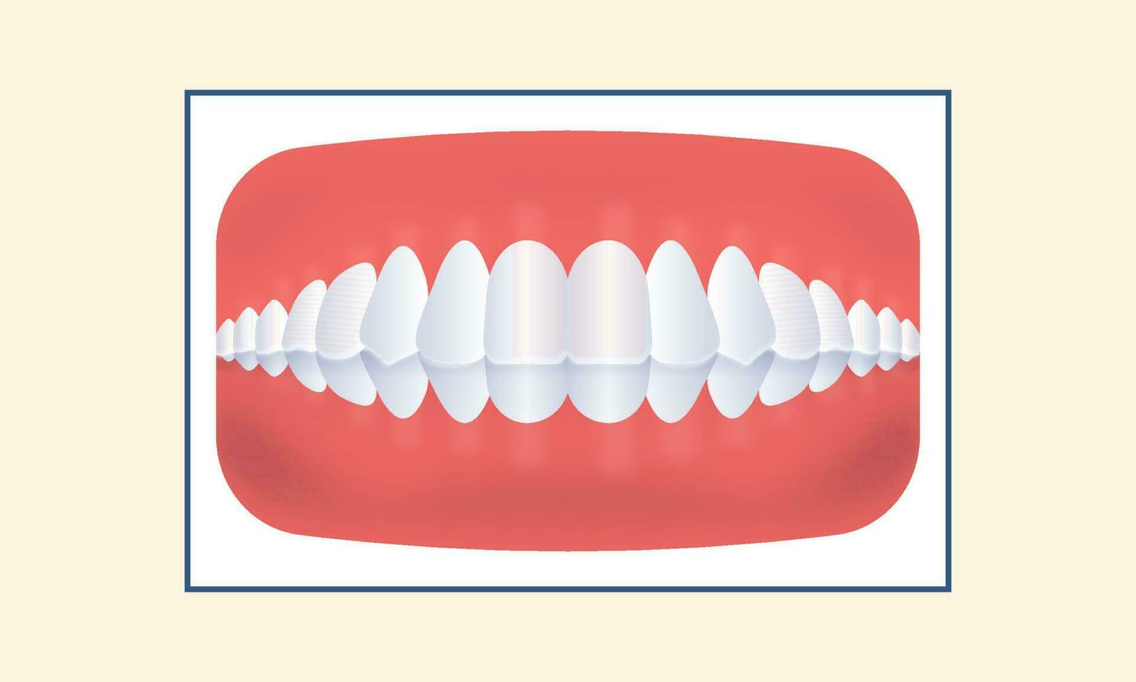 Deep Bite Human Teeth Icon Over Yellow Background. vector