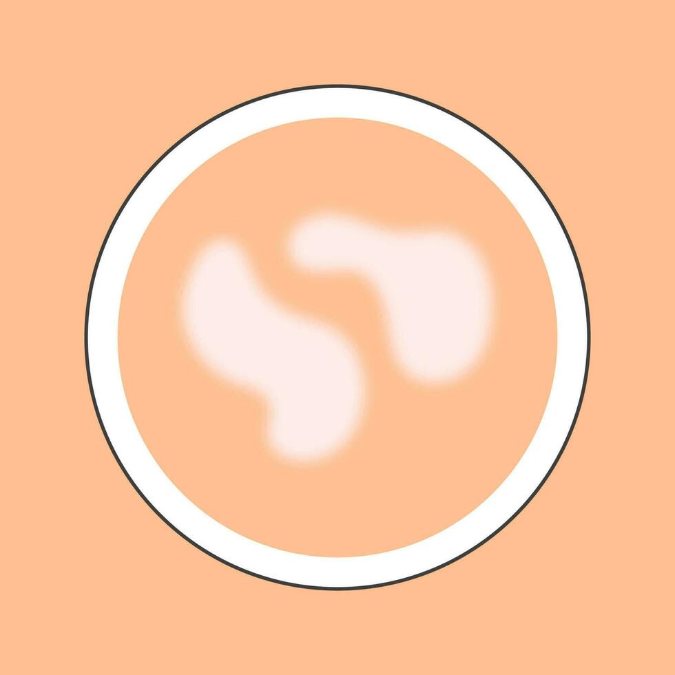 White And Peach Vitiligo Skin Disease Circle Icon In Flat Style. vector