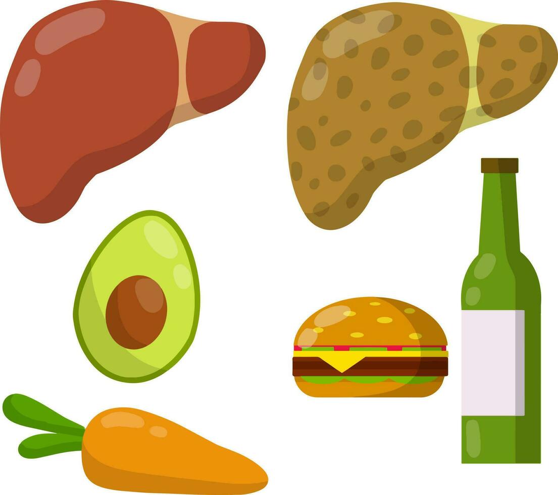 Healthy and diseased liver. Causes of illness the internal organ. Greasy Burger, alcohol beer, carrots, avocado. Medical diagnosis. Funny cartoon flat illustration. Set of Diet and good nutrition vector