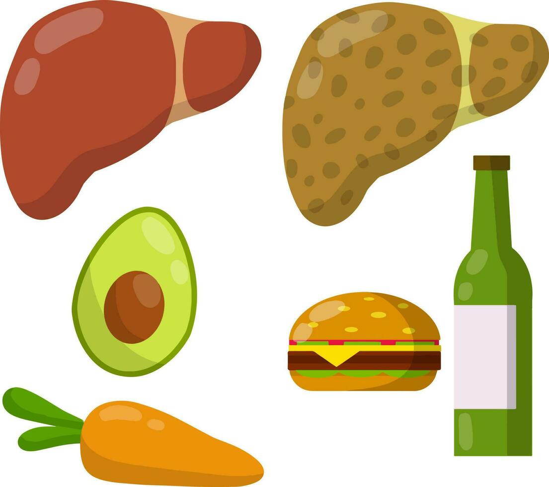 hígado sano y enfermo. causas de la enfermedad el órgano interno. hamburguesa grasienta, cerveza de alcohol, zanahorias, aguacate. diagnostico medico. divertida ilustración plana de dibujos animados. conjunto de dieta y buena nutrición vector